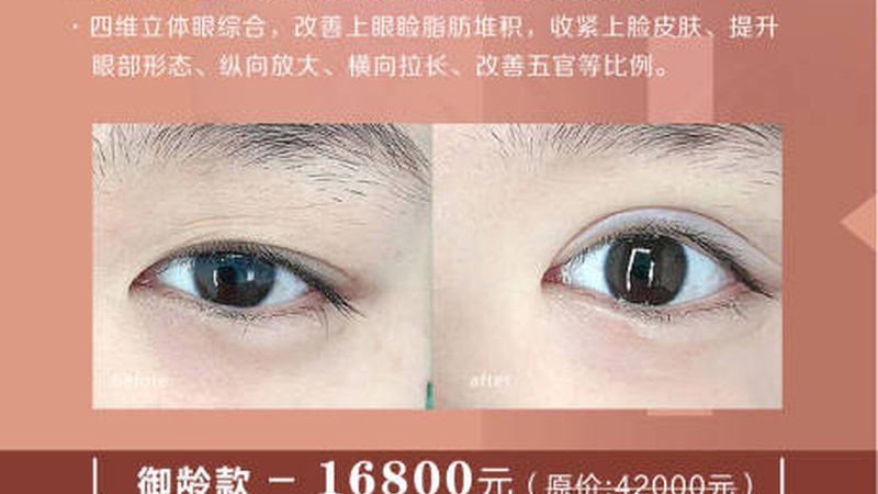 激光祛斑具有以下优势：