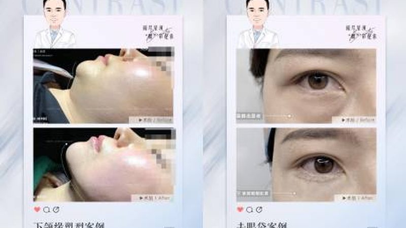 家用光子嫩肤仪，真能平替医美吗