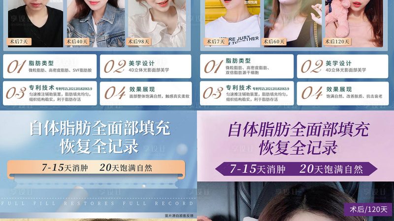 激光美容仪器ODM厂家哪家靠谱