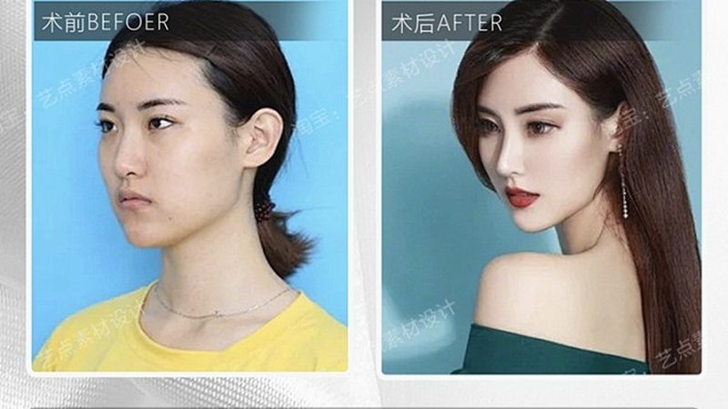 做医美前需要停用哪些护肤品