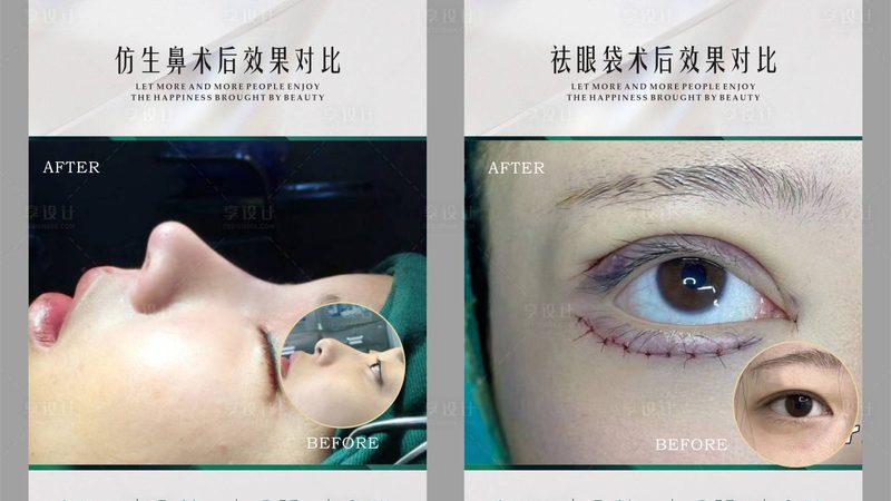 行业观察：未来抗衰美容仪将走向场景化