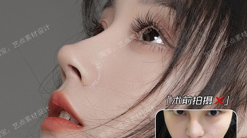 双眼皮手术安全如何？揭秘手术安全性排名背后的秘密**