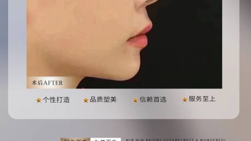 韩国皮肤管理前后对比照片流程揭秘：专业解读，安全无忧