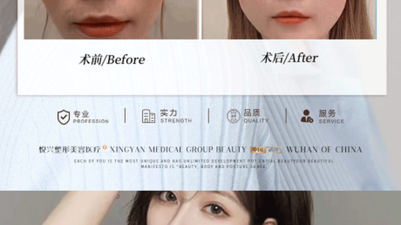 瘦脸精油正确按摩手法