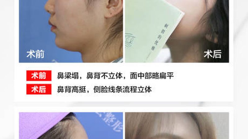 深圳整形医院与美容院：资质对比，安全之选