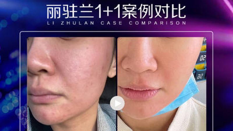 热玛吉厂家资质怎么查