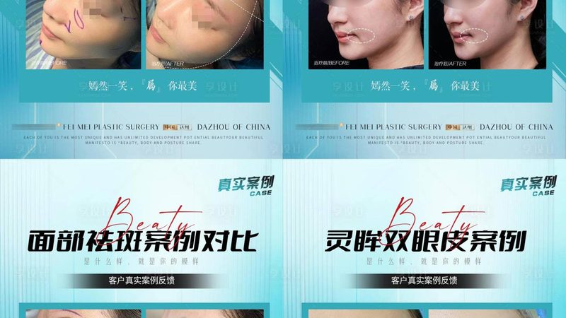 注射美容前，先看懂医生手里的“针