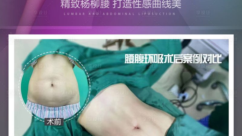 医美咨询师面试常见问题清单