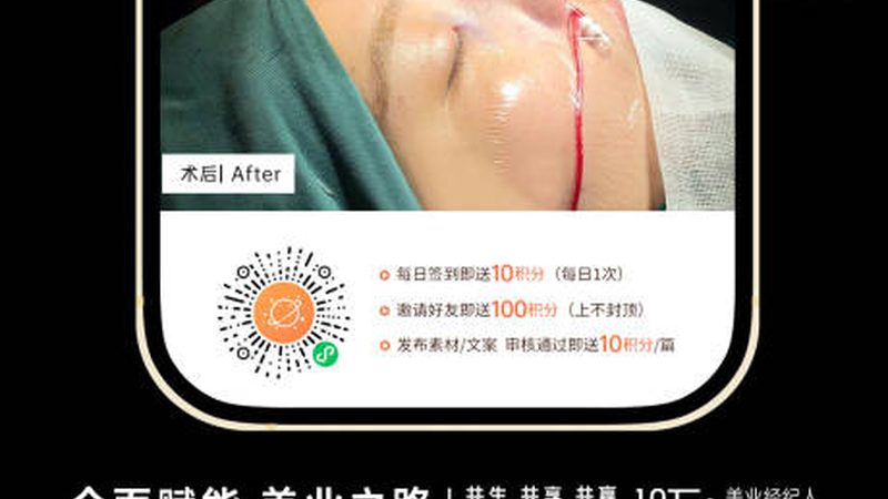 成都医美性价比之选：揭秘如何找到不贵又好的项目