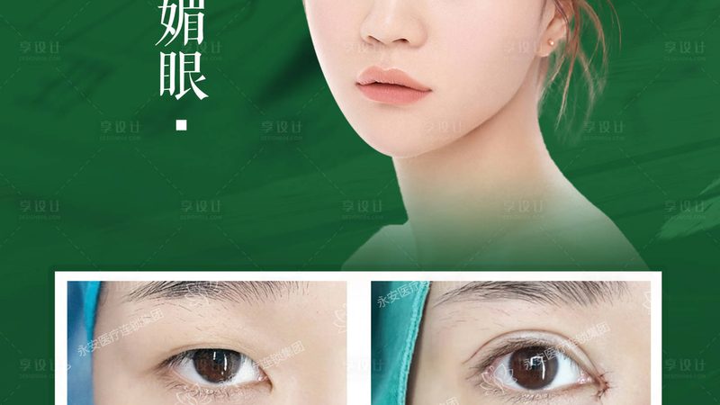 北京注射美容术后护理流程