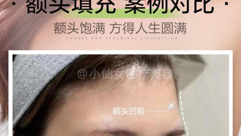 西安削骨手术：揭秘价格构成与选择要点